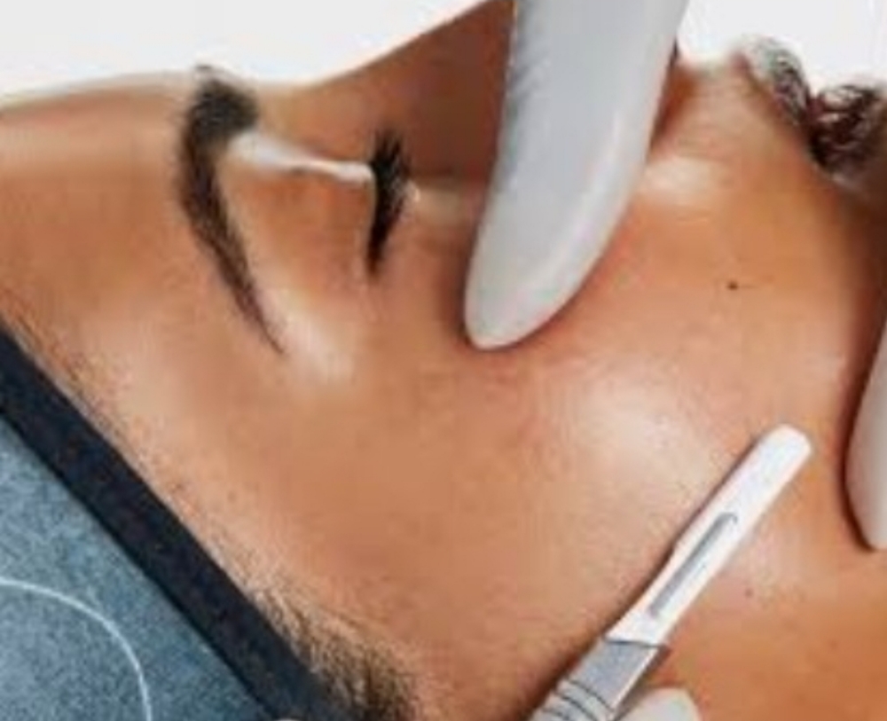 Dermaplaning With Chemical Peel