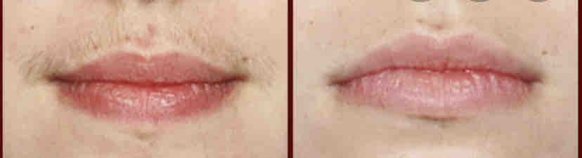 Lip Wax