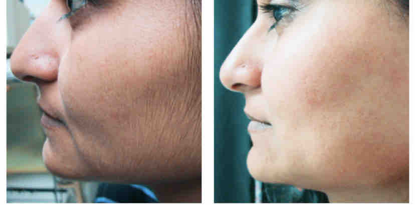 Sideburn Wax