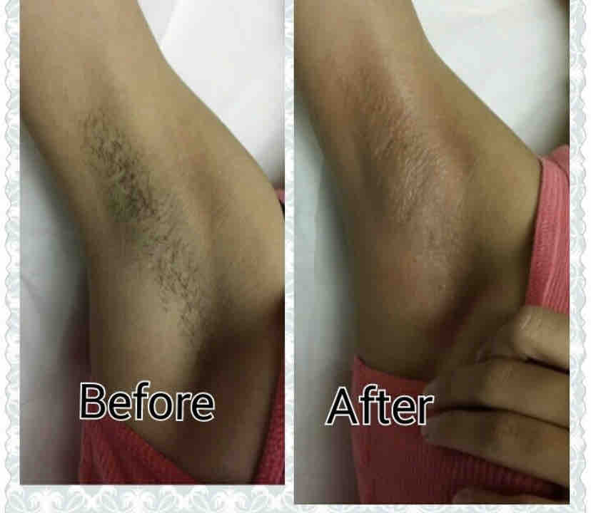 Underarm Wax