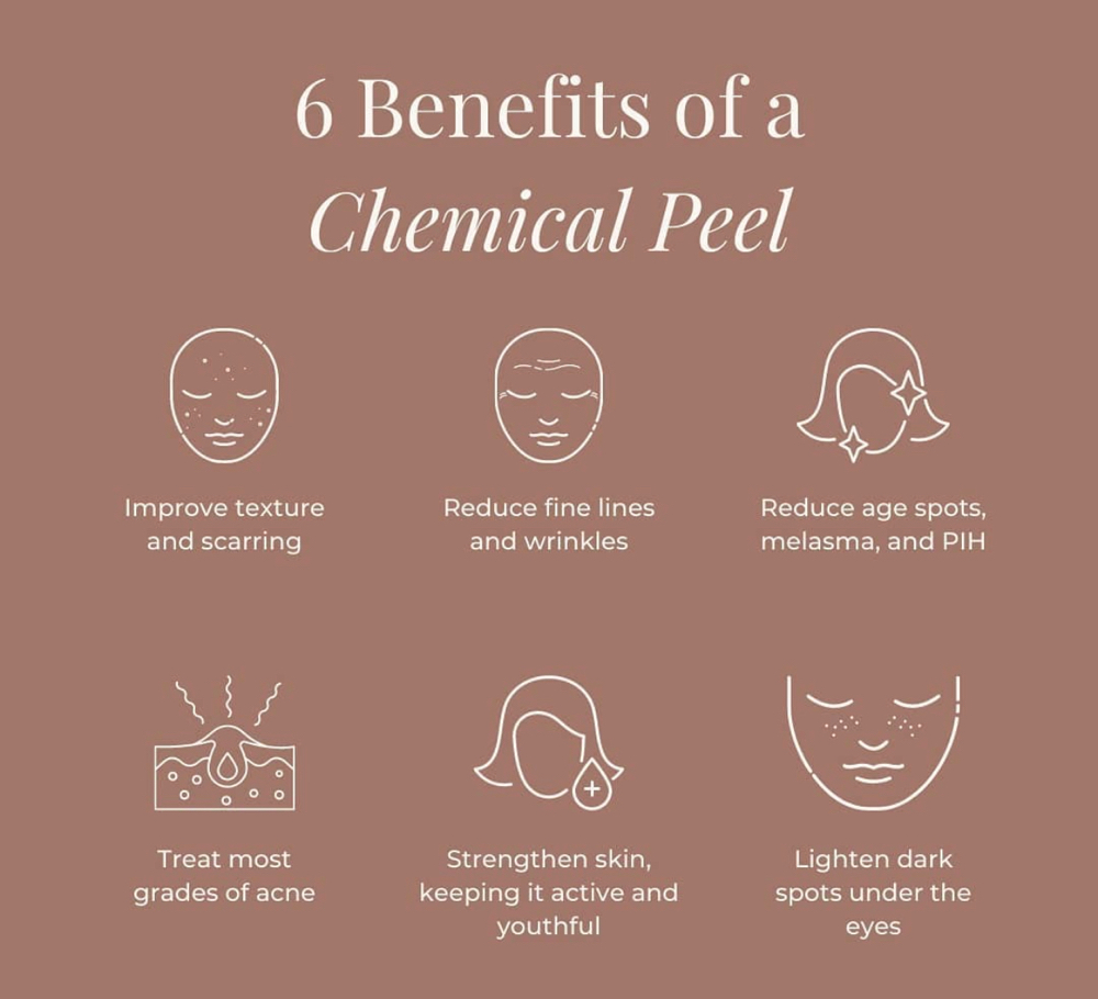 Chemical Peel Facial