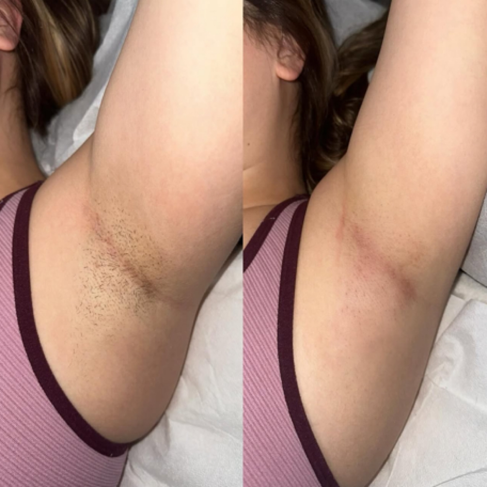 𝘼𝙍𝙈𝙋𝙄𝙏 𝙒𝘼𝙓 at Mckenzie Artistry in Norfolk, VA