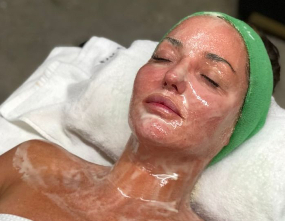 Aqua Peel Facial