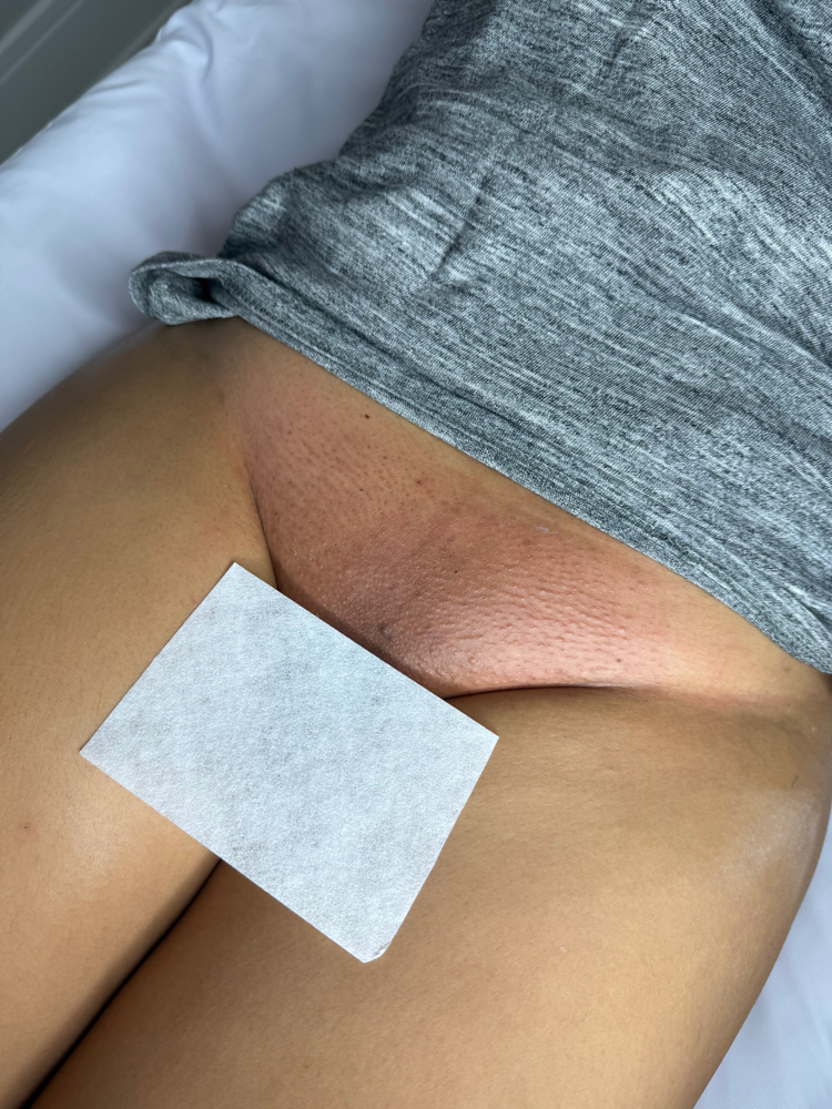 Brazilian Wax