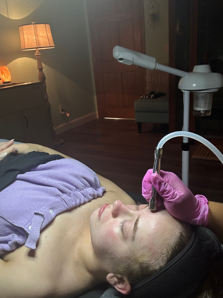 Microdermabrasion Facial