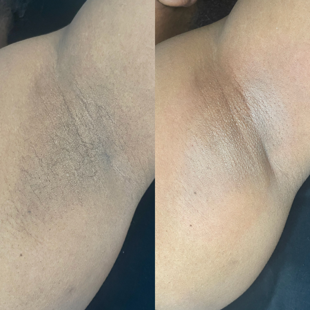 Underarm Wax at HOAG Beauty Bar in Doraville, GA