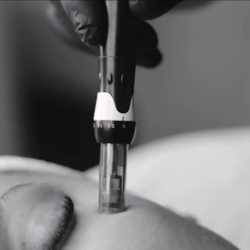 Nano-Infusion Add On