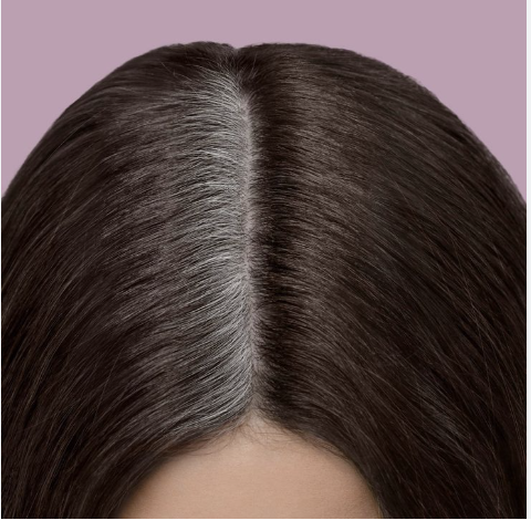 Root Re-touch