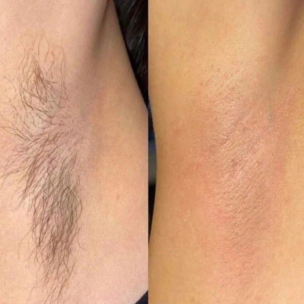 Underarm Wax at Kneaded Luxury Beauty Bar in Huntington Valley, PA