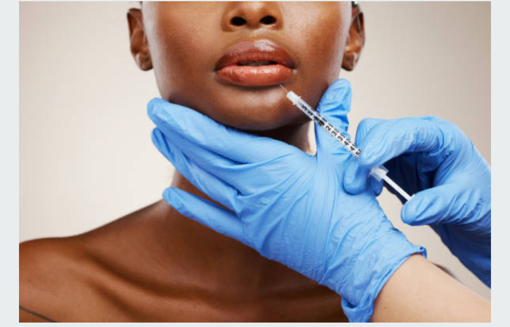 Dermal Filler injection