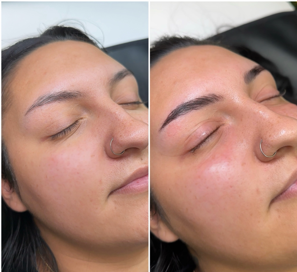 Brow Transformation.