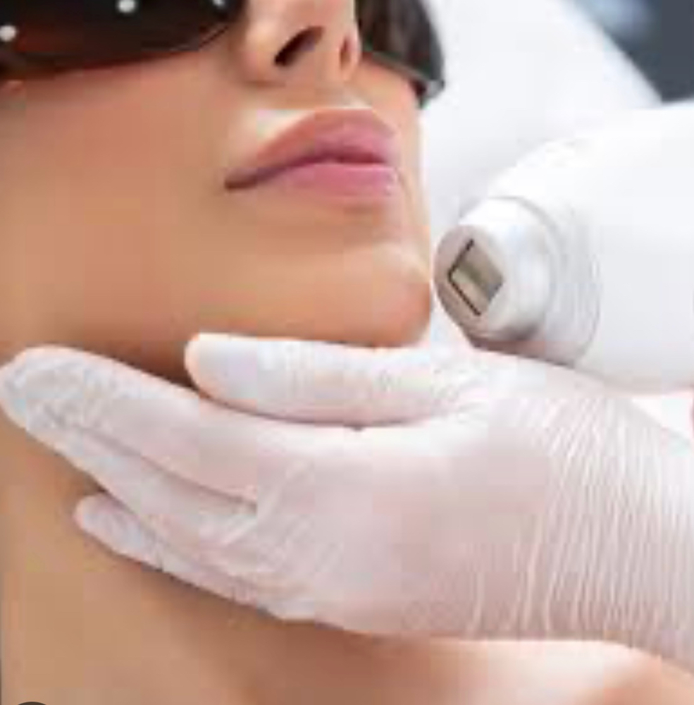 Laser Hair Removal Medium Area (6)