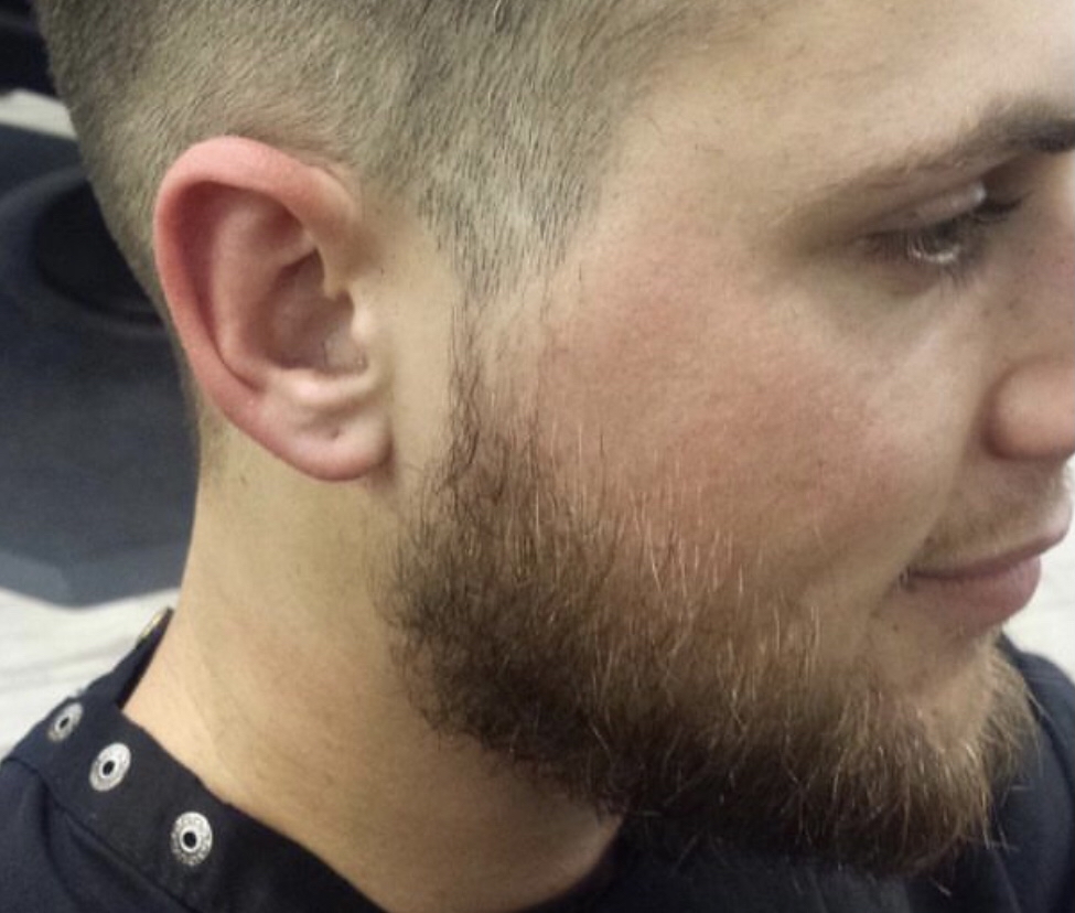 Beard trim