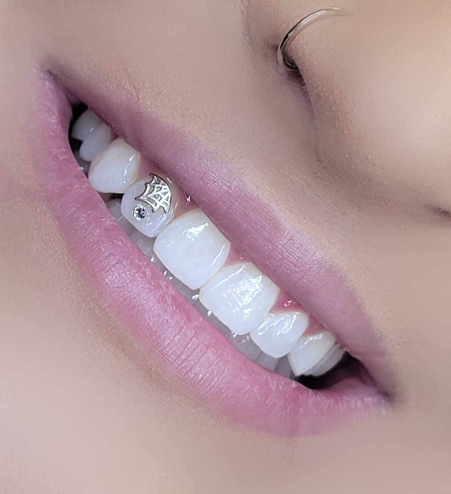 Additonal Tooth Gems