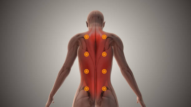 TPI