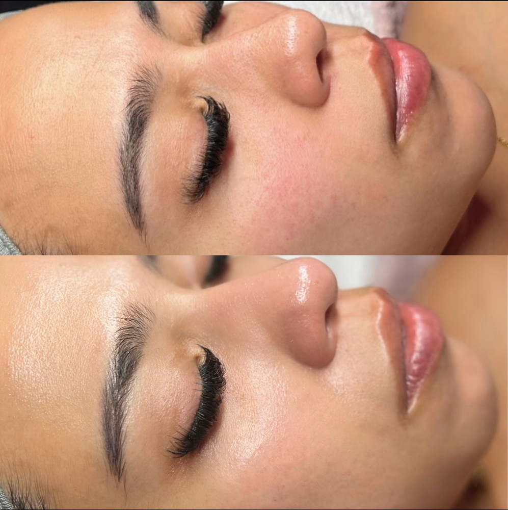 Custom Facial