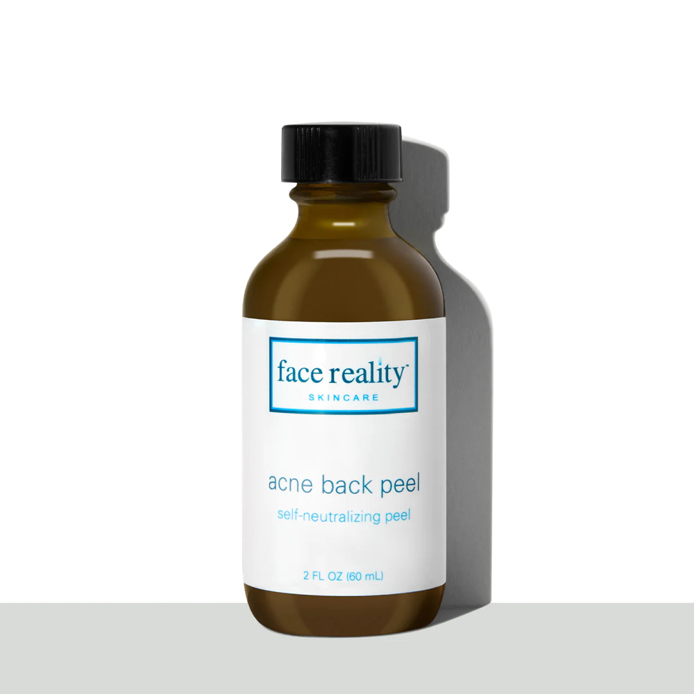 Acne Back Peel