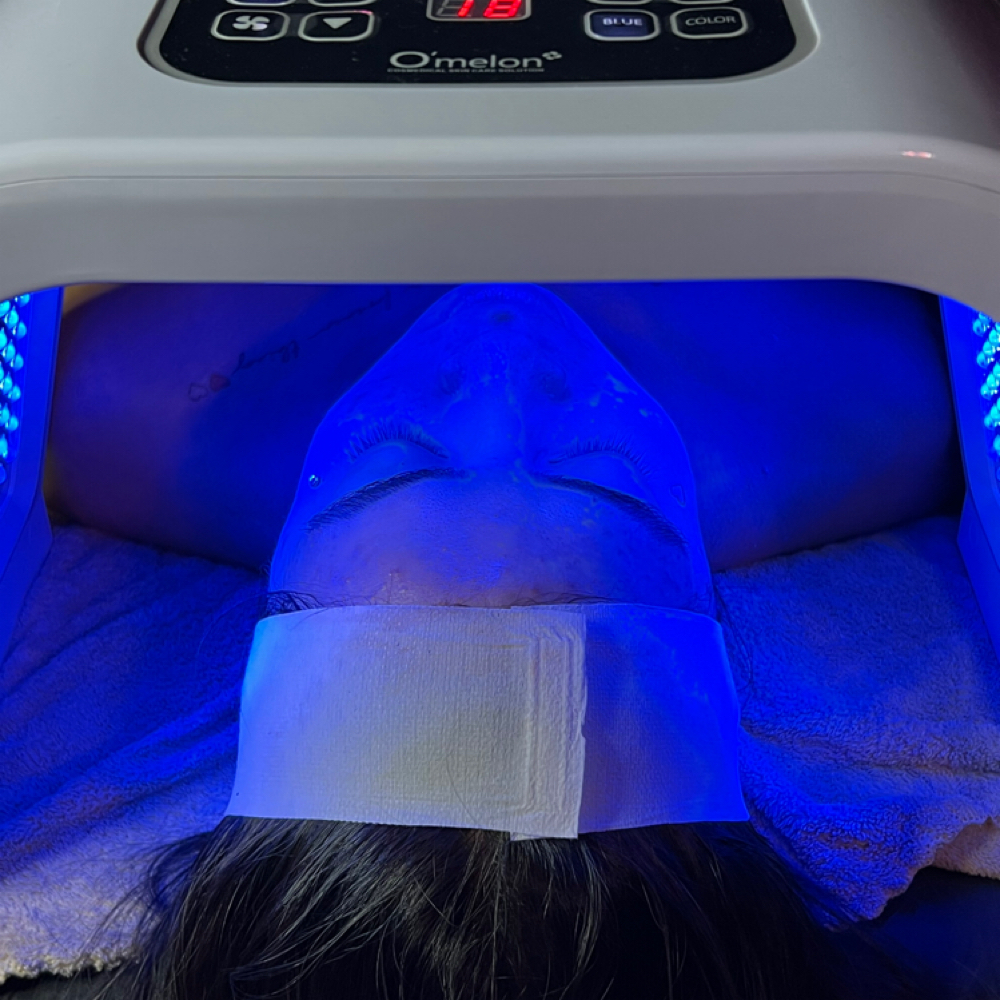 Add-on Treatments at He Nani Esthetics in Winchester, CA