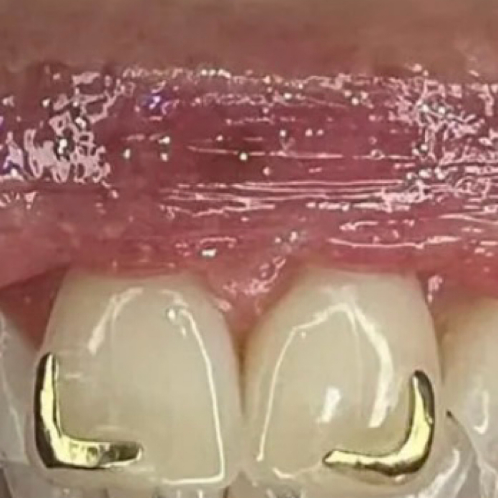 Gold L Shape charm at Envious Smiles & Beauty in Rockford, IL