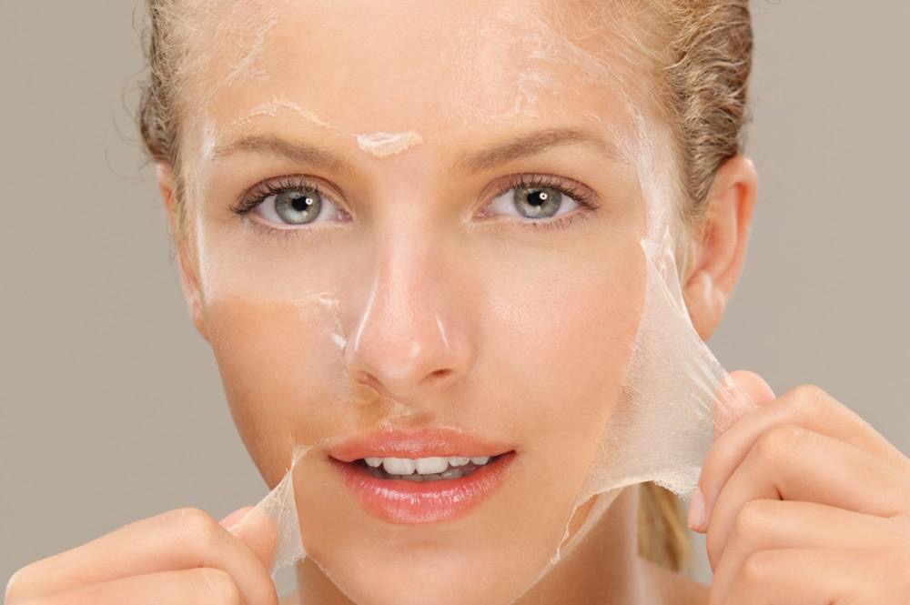 Chemical Peel