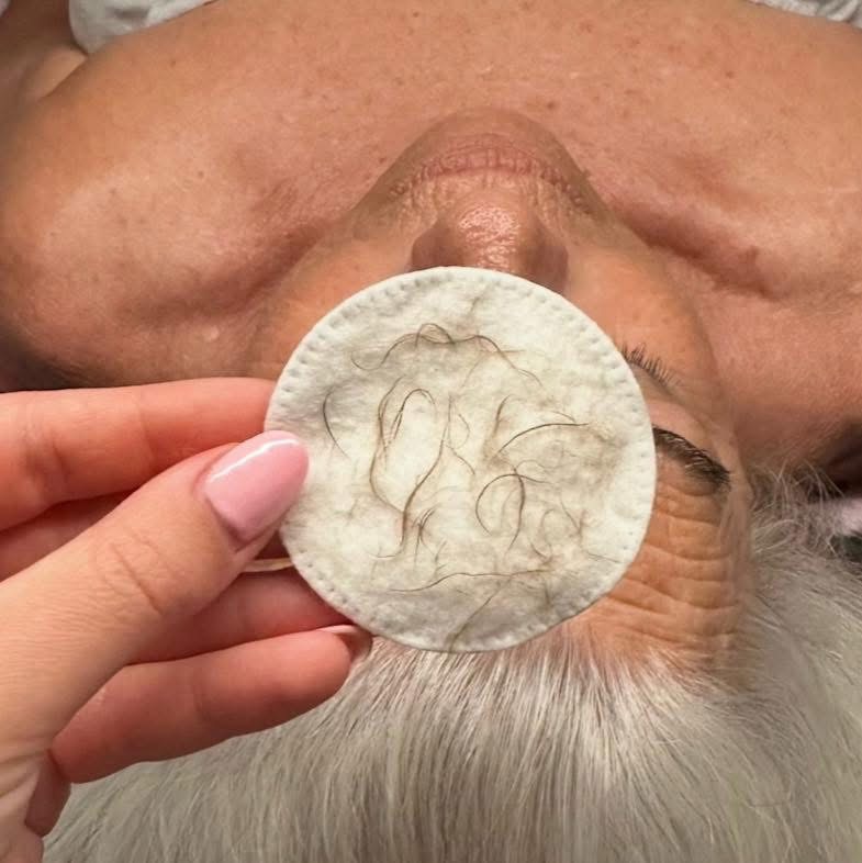 Dermaplane (add-on)