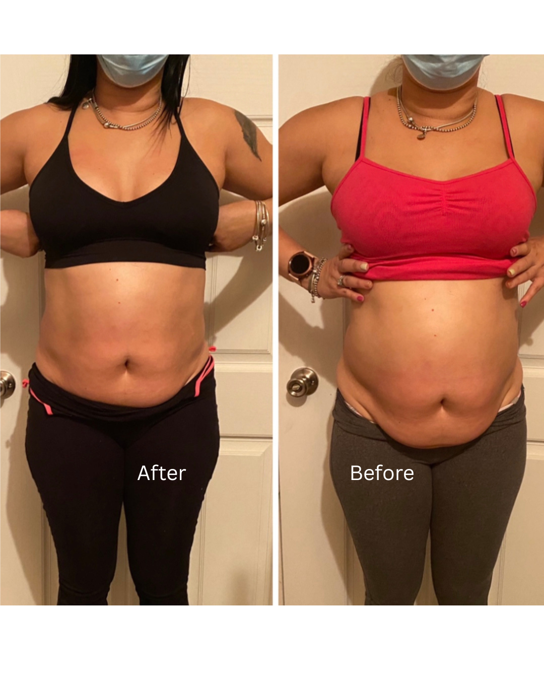 In Home Body Contouring