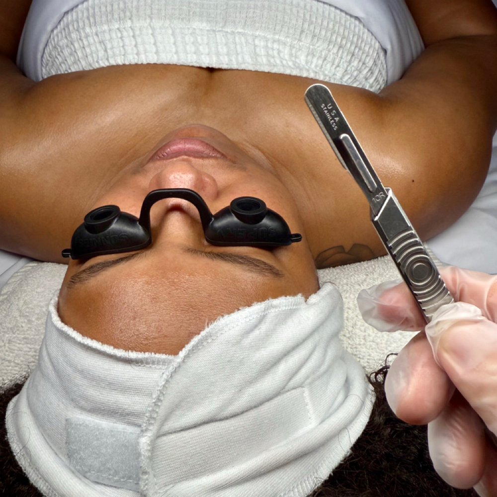 May Special Add On Dermaplane at Esthetics By Lena in Louisville, KY