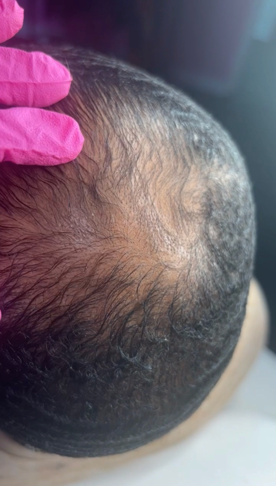 Hair Growth (men&women)