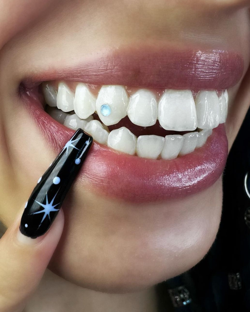 Tooth Gem