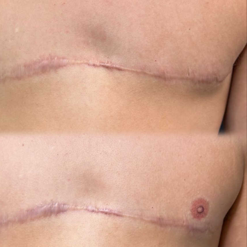 Gender Affirming Care For 2 at Cosmetic Studio 54 in Los Angeles, CA