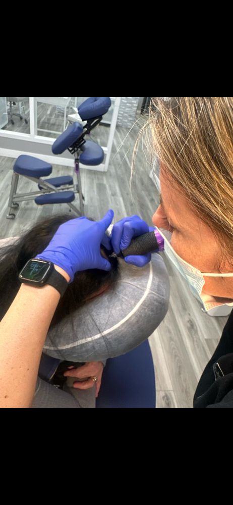 SMP - Scalp Micropigmentation