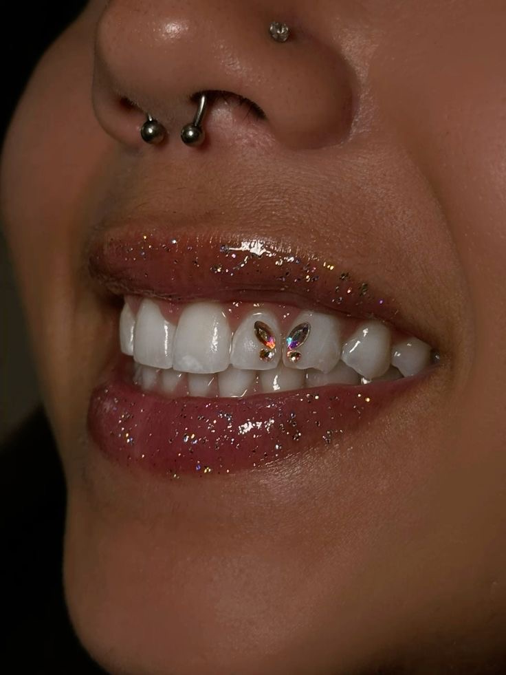 Tooth Gems