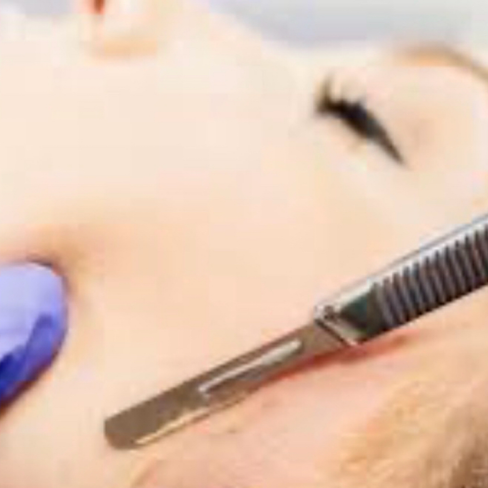 Dermaplane at Ash Glow Aesthetics in Staten Island, NY