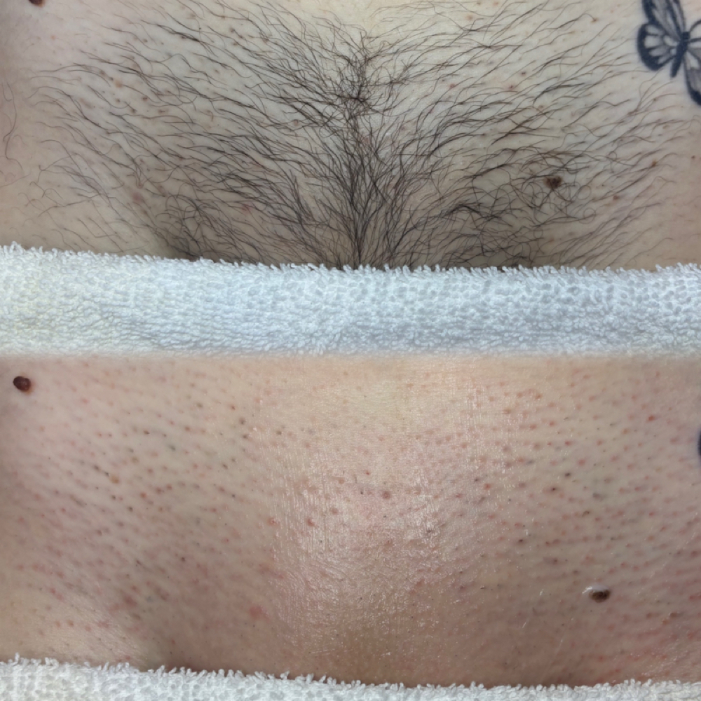 Brazilian Waxing at Heavenly Skin Spa in Shorewood, IL