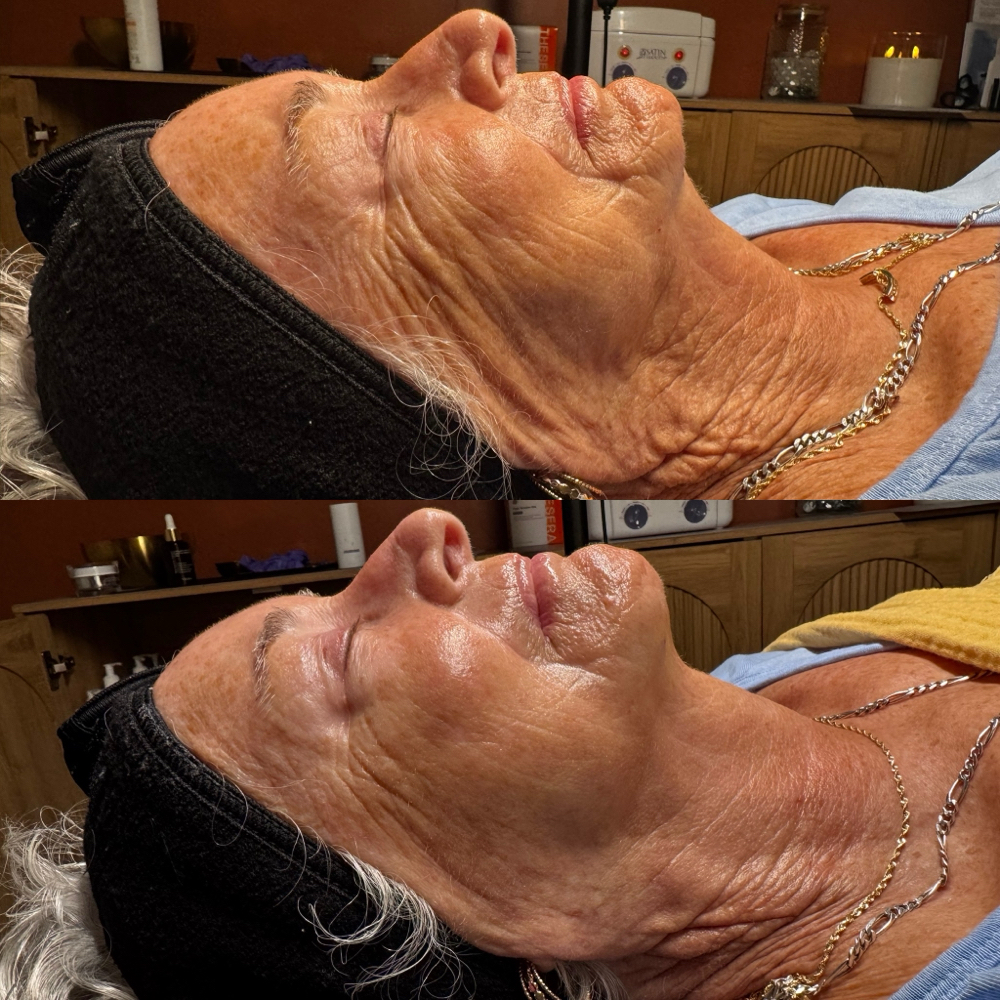 Firming,Tightening & Lift Treatment at Skin By Sarah in Niles, OH