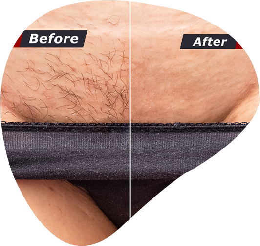 Brazillian Wax - Maintenance at Trusted Touch Skin Spa in Ruidoso Downs, NM