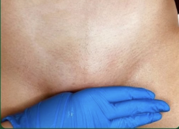 Brazilian Wax