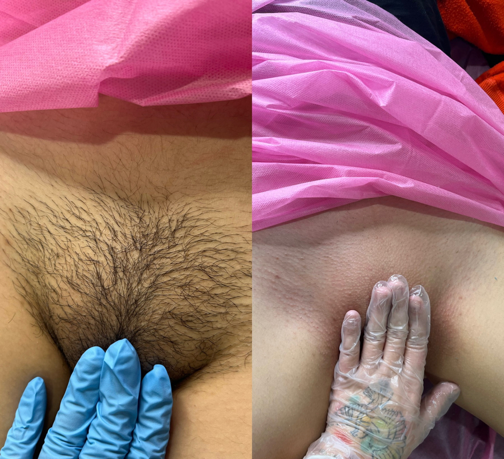 Waxing