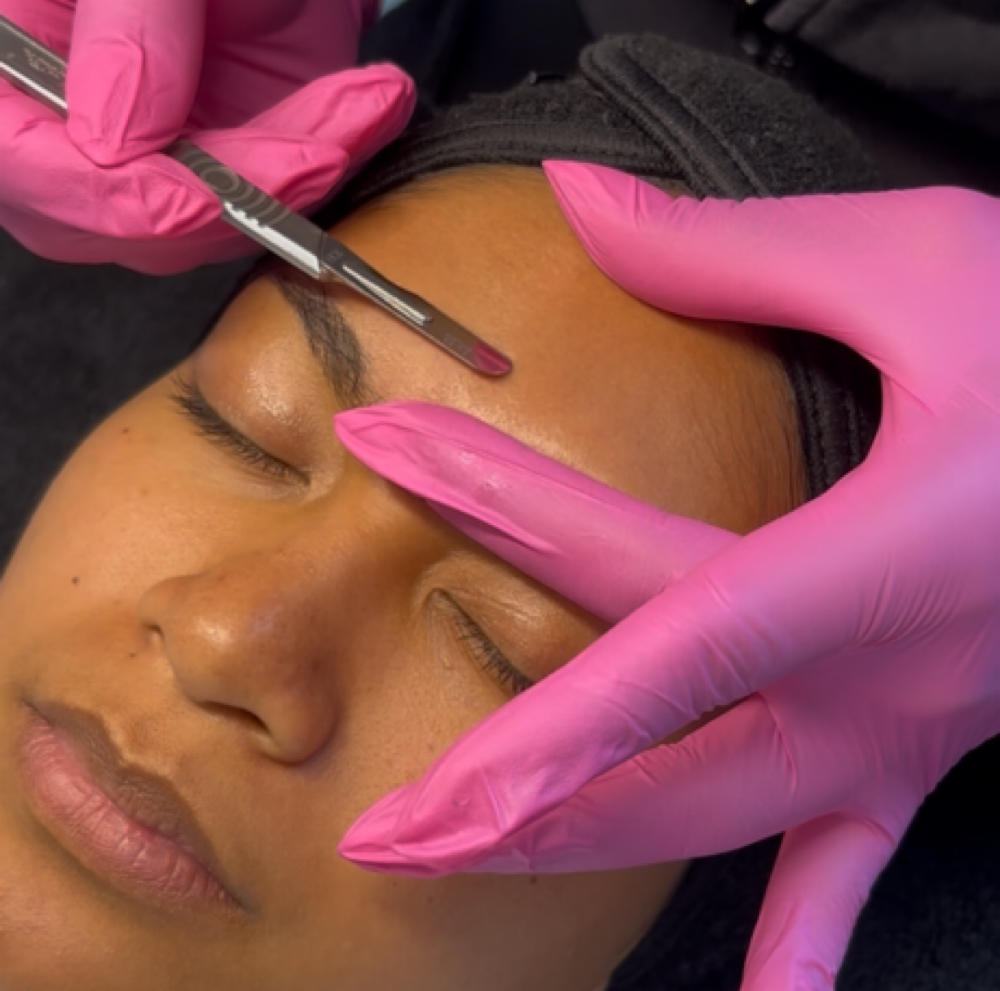 DERMAPLANING ADD ON at BLOOM SIGNATURE AESTHETICS LLC in Canoga Park, CA