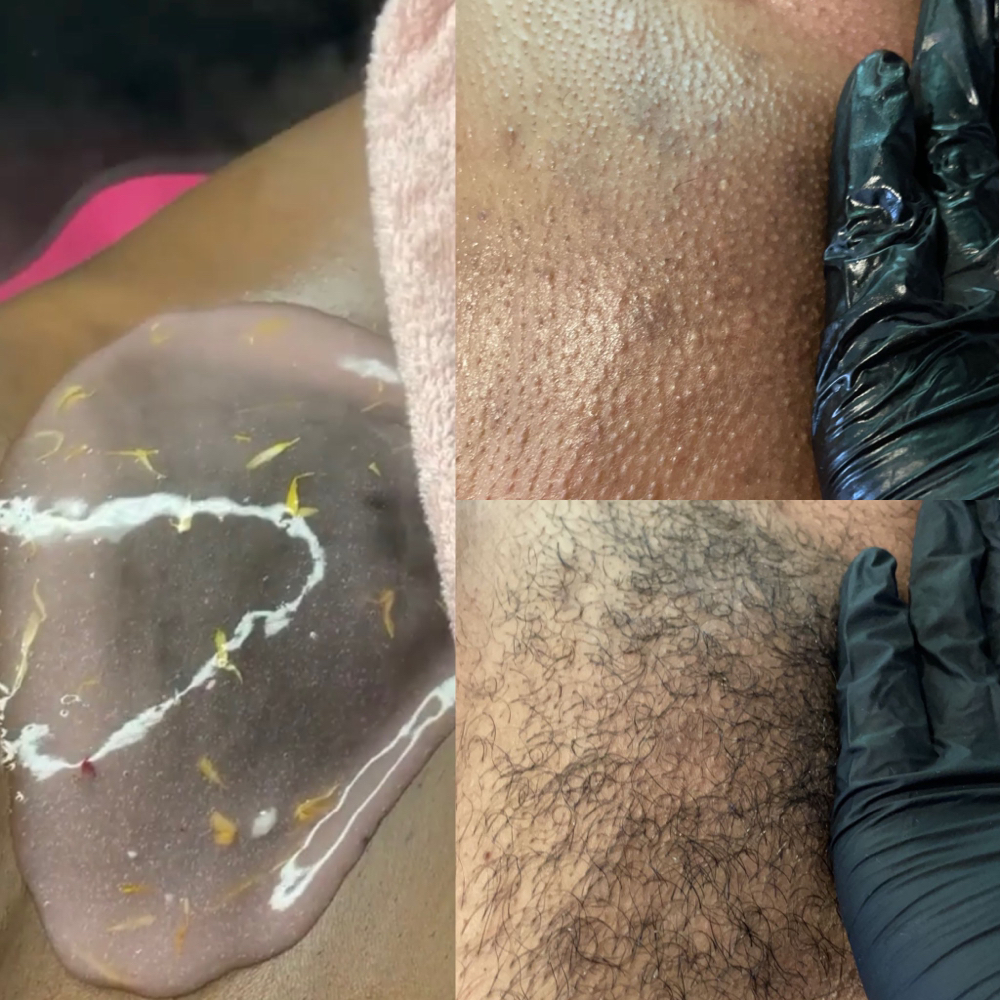 Brazillian Wax And Vajacial