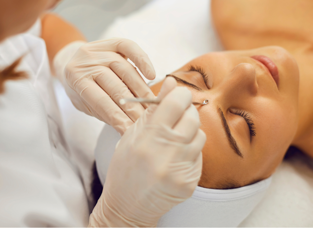 Acne Facial
