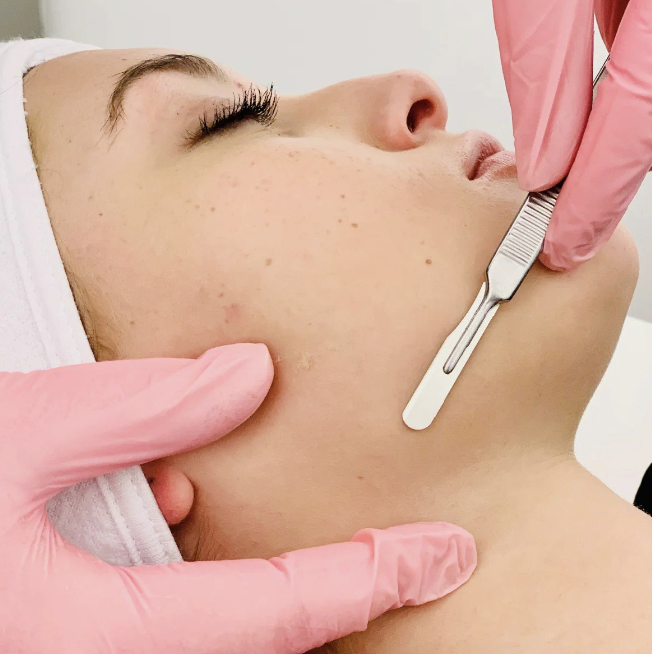 Dermaplaning Facial