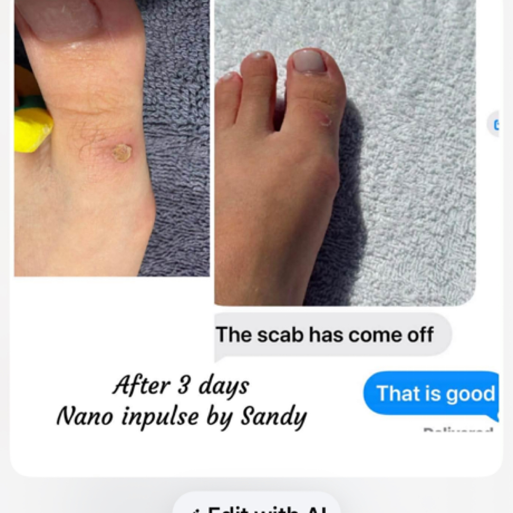 Scar at Excellent Nails By Sandy in California, CA