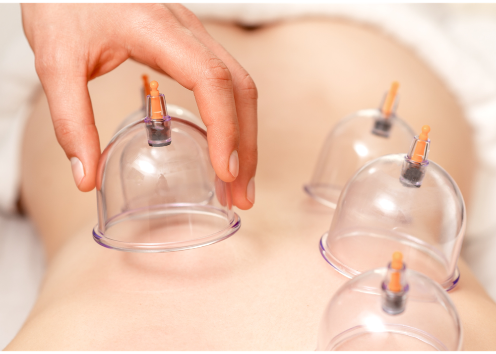 Cupping/Gua Sha Therapy w: Alignmen