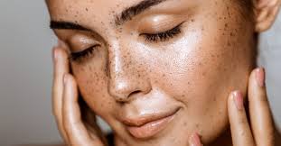 Beauty Infusion