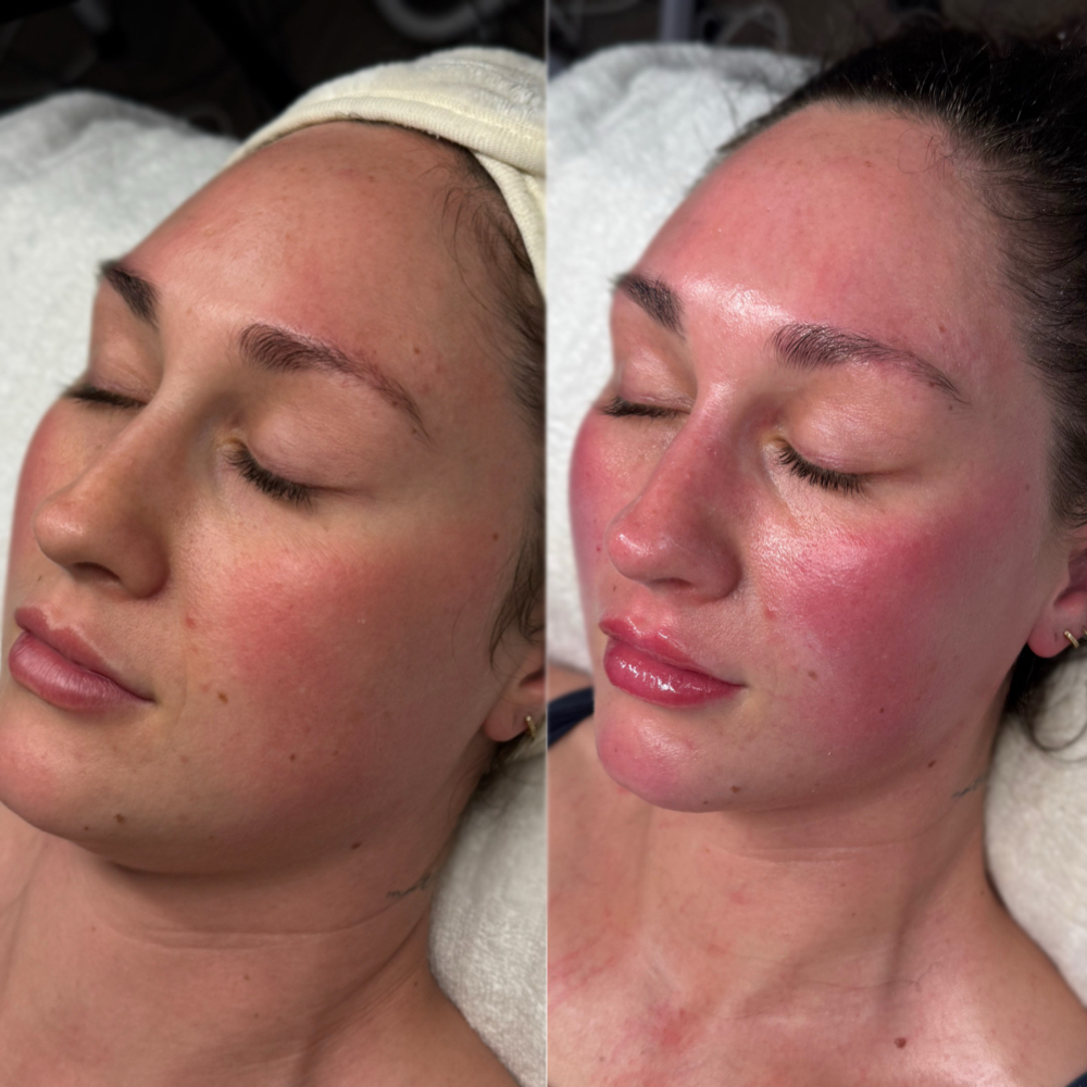 Phecial™ Snatch + Sculpt at Phe Michelle Beauty in Texarkana, TX