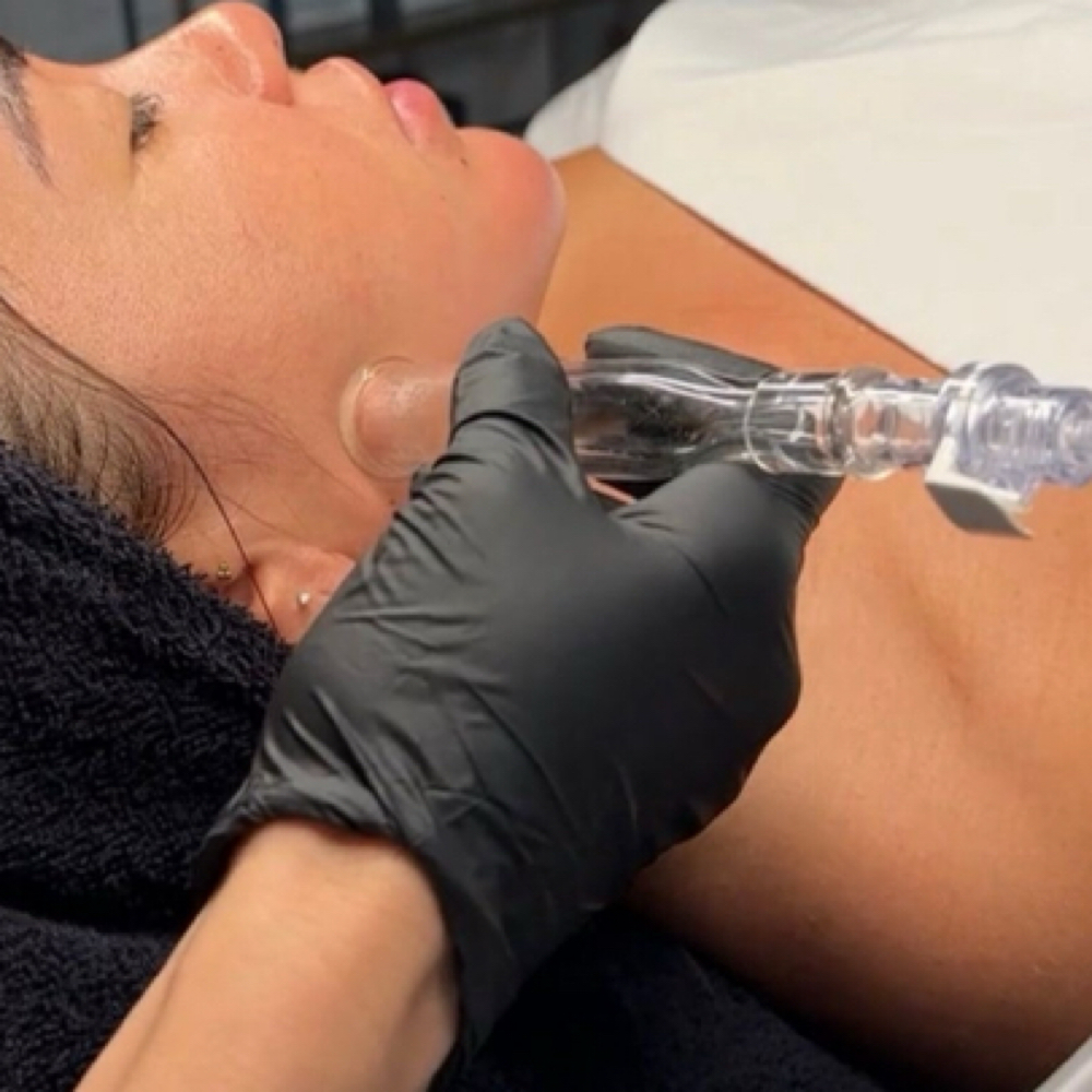 Add on - Lymphatic Drainage at VOGUE AESTHETICS in Okeechobee, FL