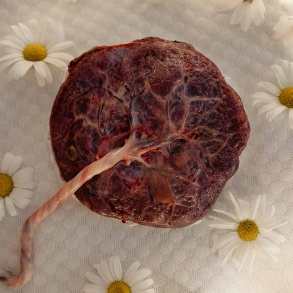 Placenta Encapsulation