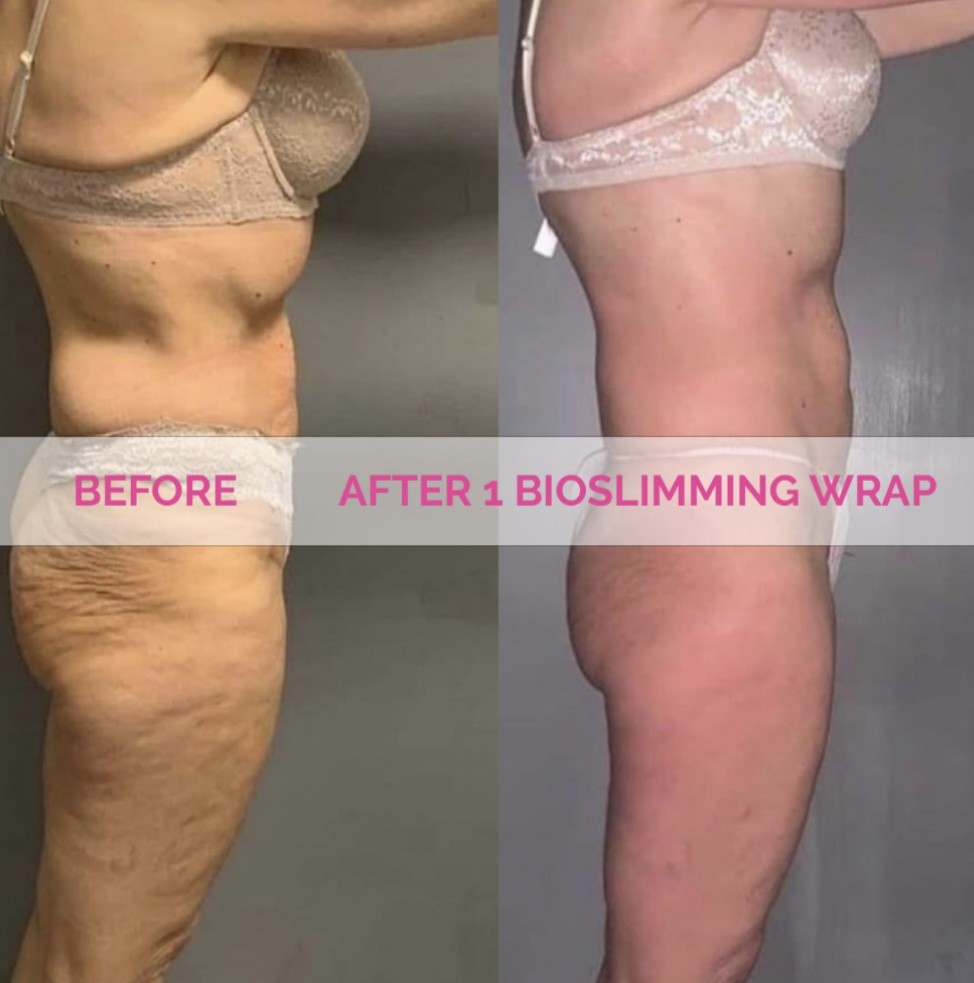 Bioslimming Wrap