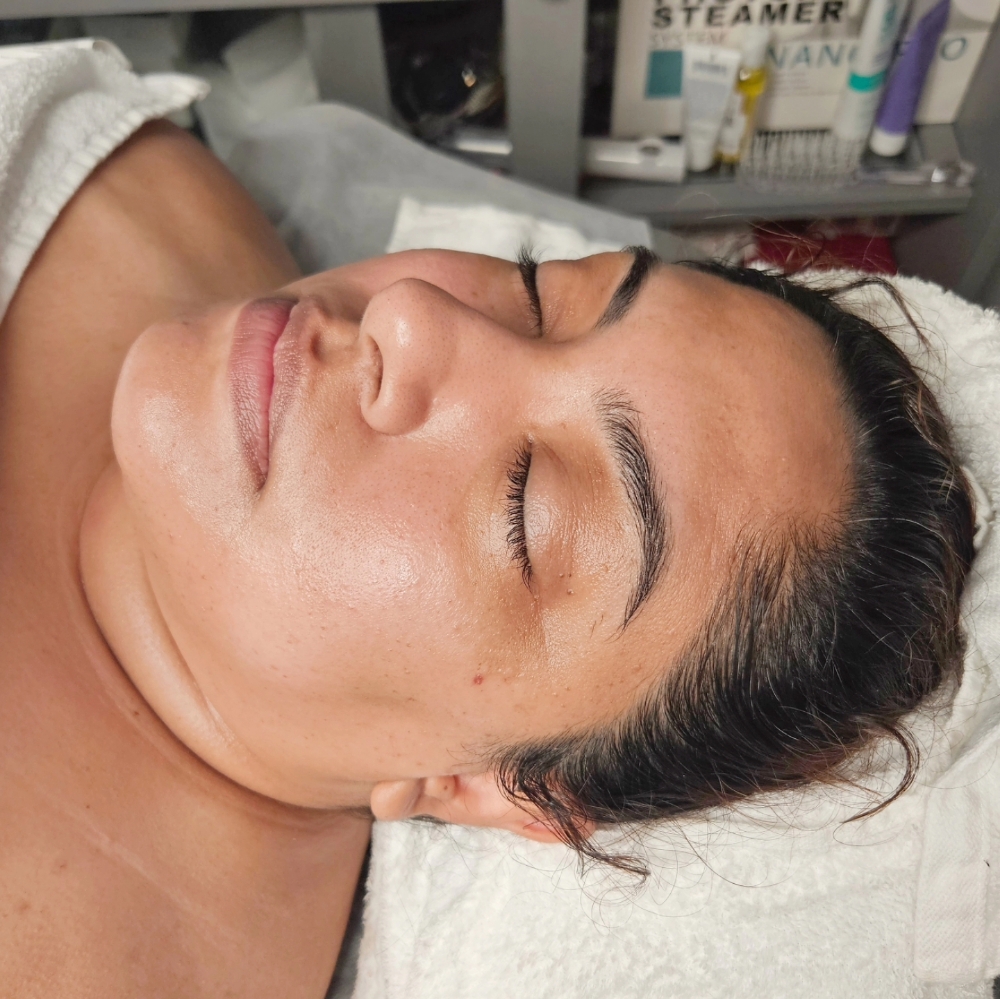 SkinTAG/Dark Spot Removal/Session
